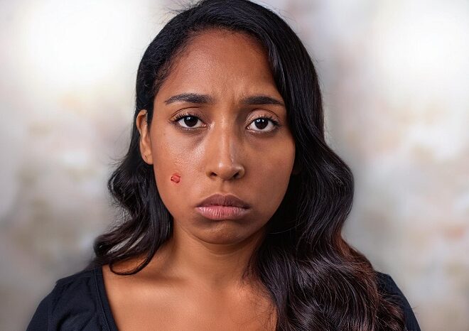 Herpes in India: The Mood Swings No One Talks About